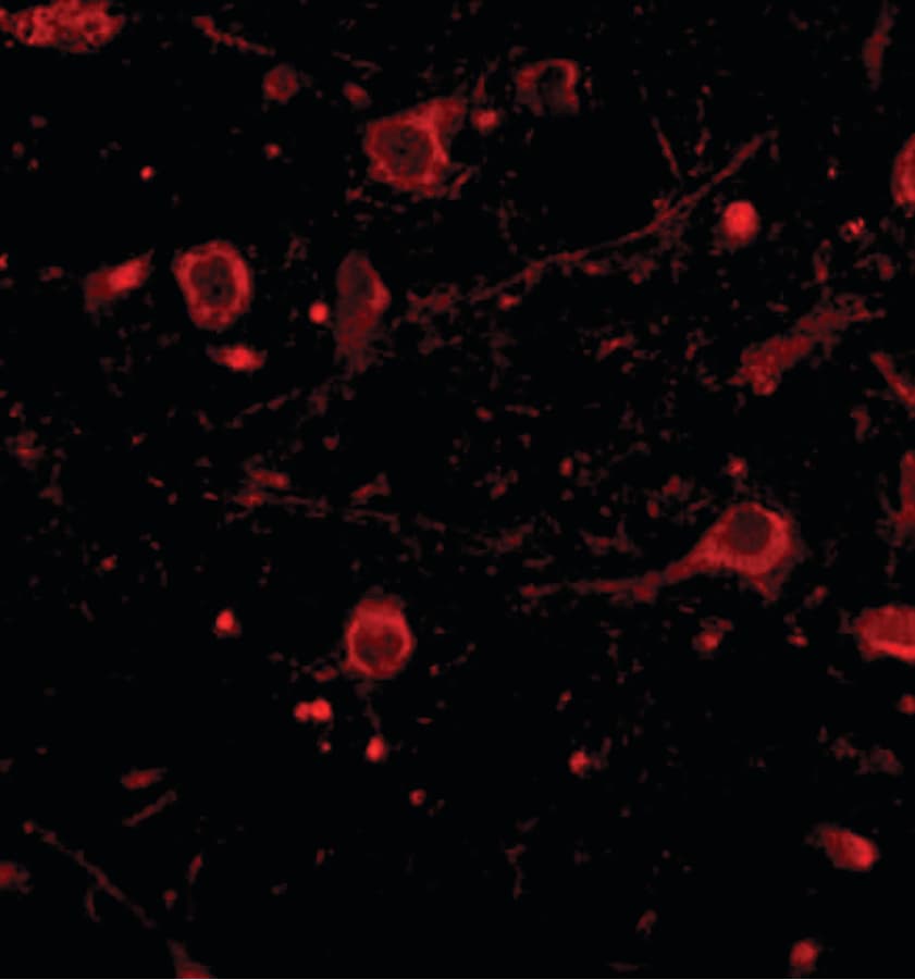 IHC-plus™ CADPS Antibody