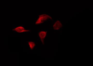 CHUK / IKKA / IKK Alpha Antibody (phospho-Ser176,pSer177)