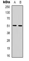 ADRB1 Antibody (Internal)