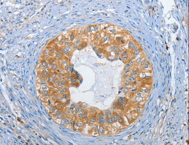 DGKZ Antibody