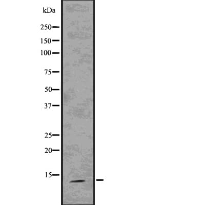 S100A9 / MRP14 Antibody