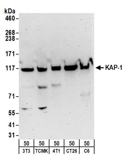TRIM28 / KAP1 Antibody (aa1-50)