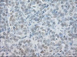 SORD / Sorbitol Dehydrogenase Antibody (clone OTI2A10)