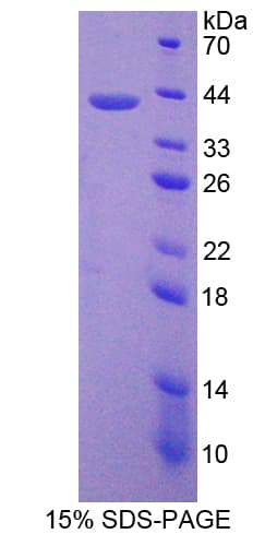 Human GNB2 Protein (Recombinant His-T7)