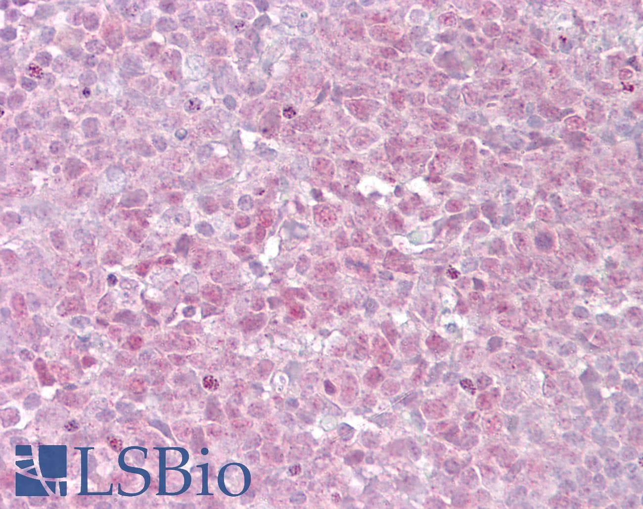 IHC-plus™ TERF2 / TRF2 Antibody