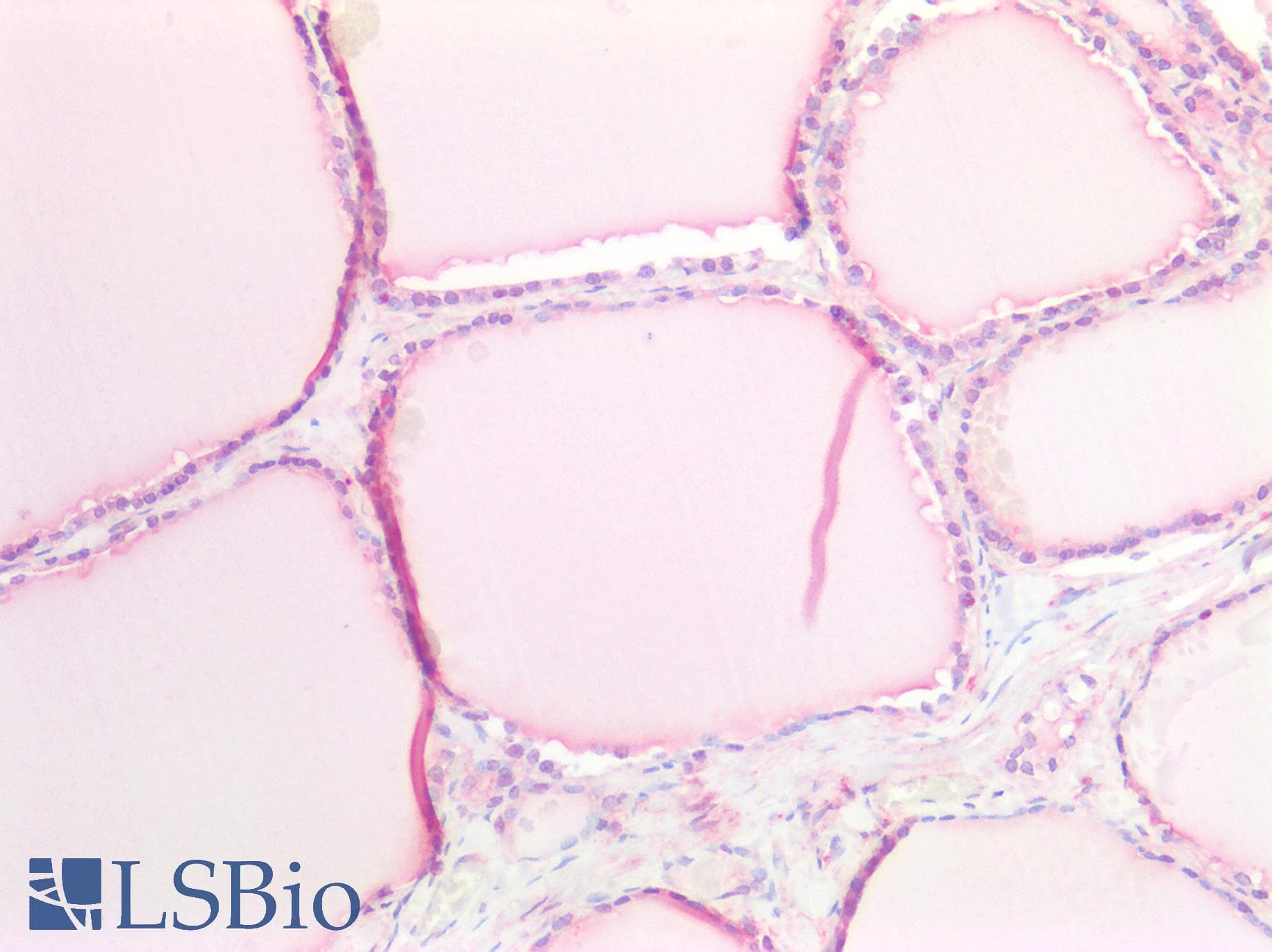 PathPlus™ EMP2 Antibody