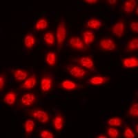 EZH2 Antibody
