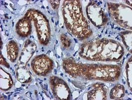 FGFR2 / FGF Receptor 2 Antibody (clone OTI3F8)