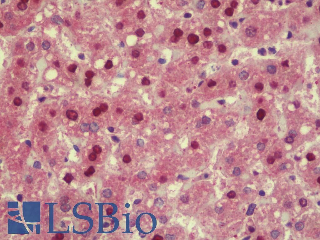 IHC-plus™ TMPO / TP / Thymopoietin Antibody