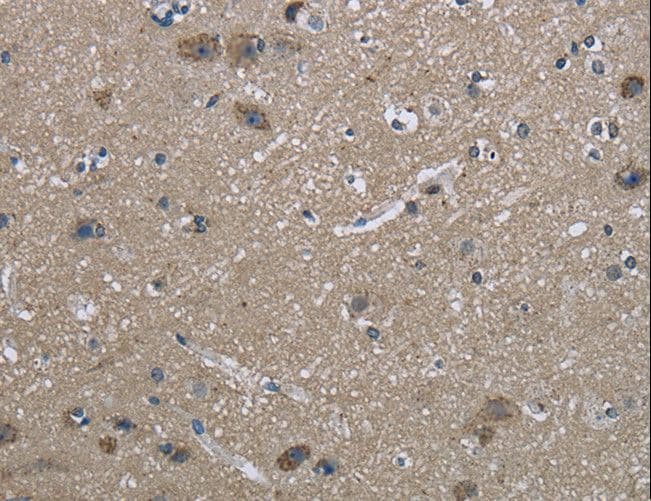 HSPA9 / Mortalin / GRP75 Antibody