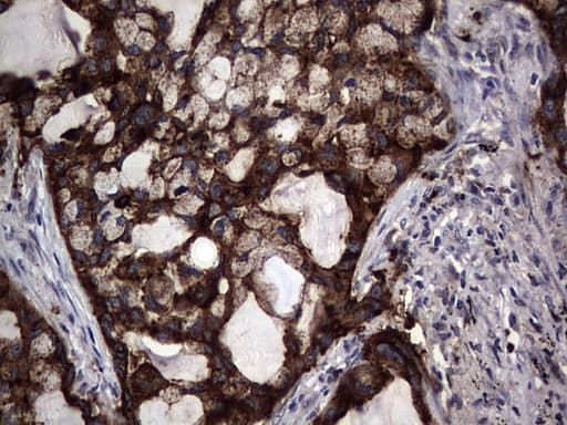 Monoclonal Mouse anti-Human CEACAM5 / CD66e Antibody (clone OTI5F2, aa35-680, IHC, WB)