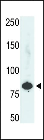 PFKL Antibody (aa669-699)