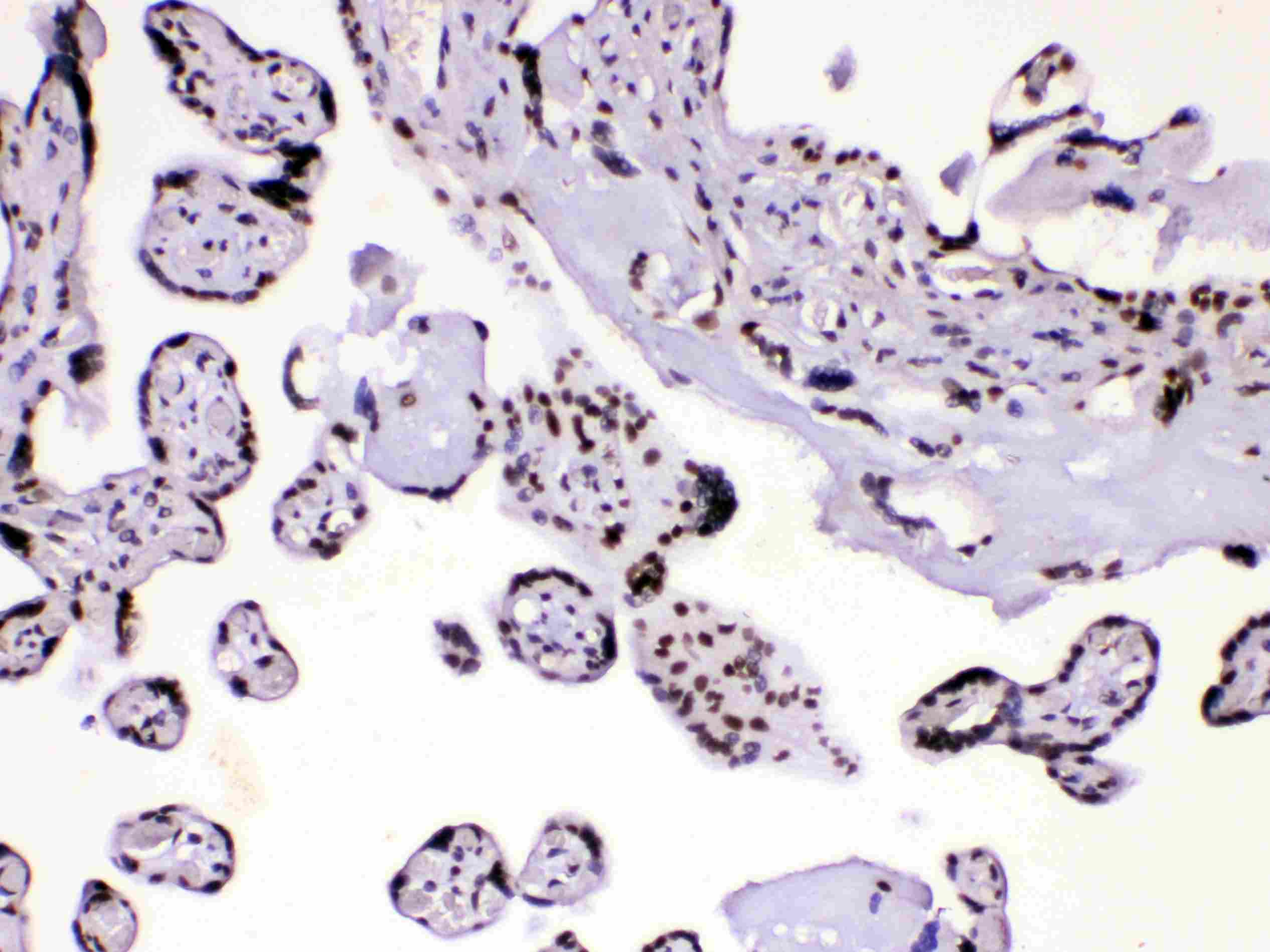 HNRPA1 / HnRNP A1 Antibody