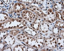 AKR1A1 Antibody (clone OTI4G6)