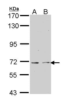 KAT5 / TIP60 Antibody