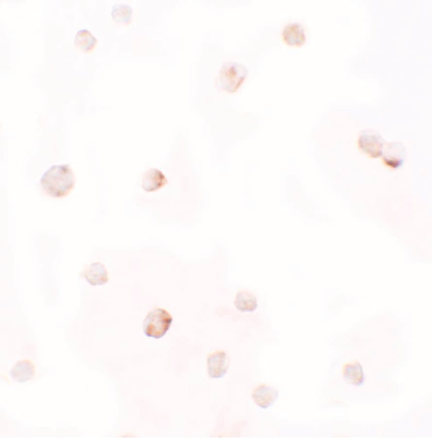 IHC-plus™ PELI1 / Pellino 1 Antibody