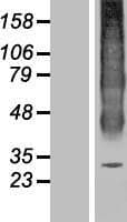 AQP6 / Aquaporin 6 Protein (Over-Expression Lysate Myc-DDK (Flag))