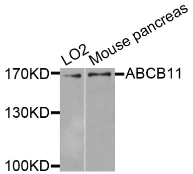 Polyclonal Rabbit anti-Human ABCB11 / BSEP Antibody (WB)