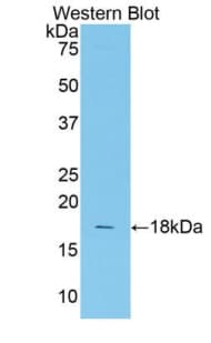 TCF20 Antibody (aa1656-1792, Biotin)
