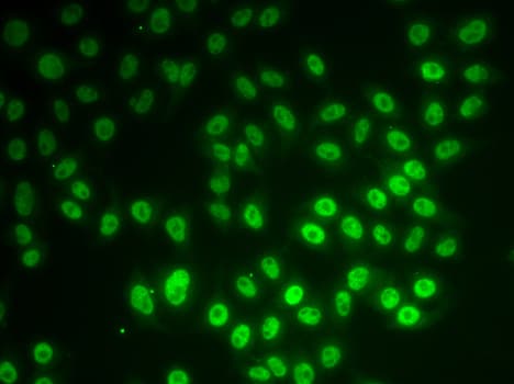 Polyclonal Rabbit anti-Human SNRPD1 / SMD1 Antibody (IHC, IF, WB)