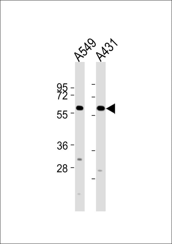 CYP2J2 Antibody