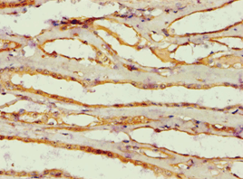 AMY2B Antibody (aa16-320)