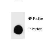 BAD Antibody (phospho-Tyr113)