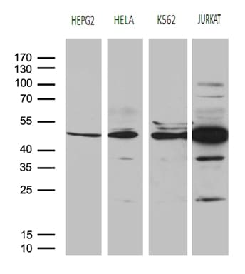 RRM2 Antibody (clone OTI3D3)