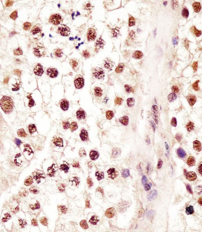 Polyclonal Rabbit anti-Human RBMX Antibody (aa262-294, IHC, WB)