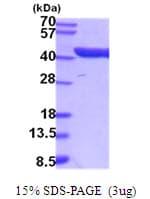 Mouse ALDOC / Aldolase C Protein (Recombinant His)