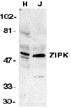 DAPK3 / ZIP Kinase Antibody (aa279-298)