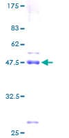 Human SNX24 Protein (Recombinant GST)