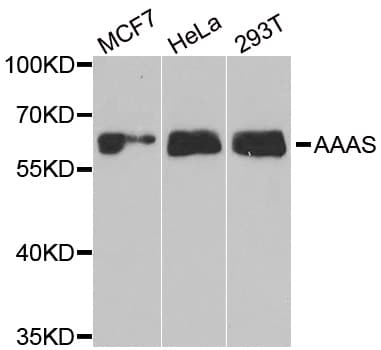 AAAS / Adracalin Antibody