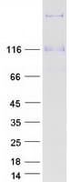 Human COL21A1 / Collagen XXI Protein (Recombinant Myc-DDK (Flag))