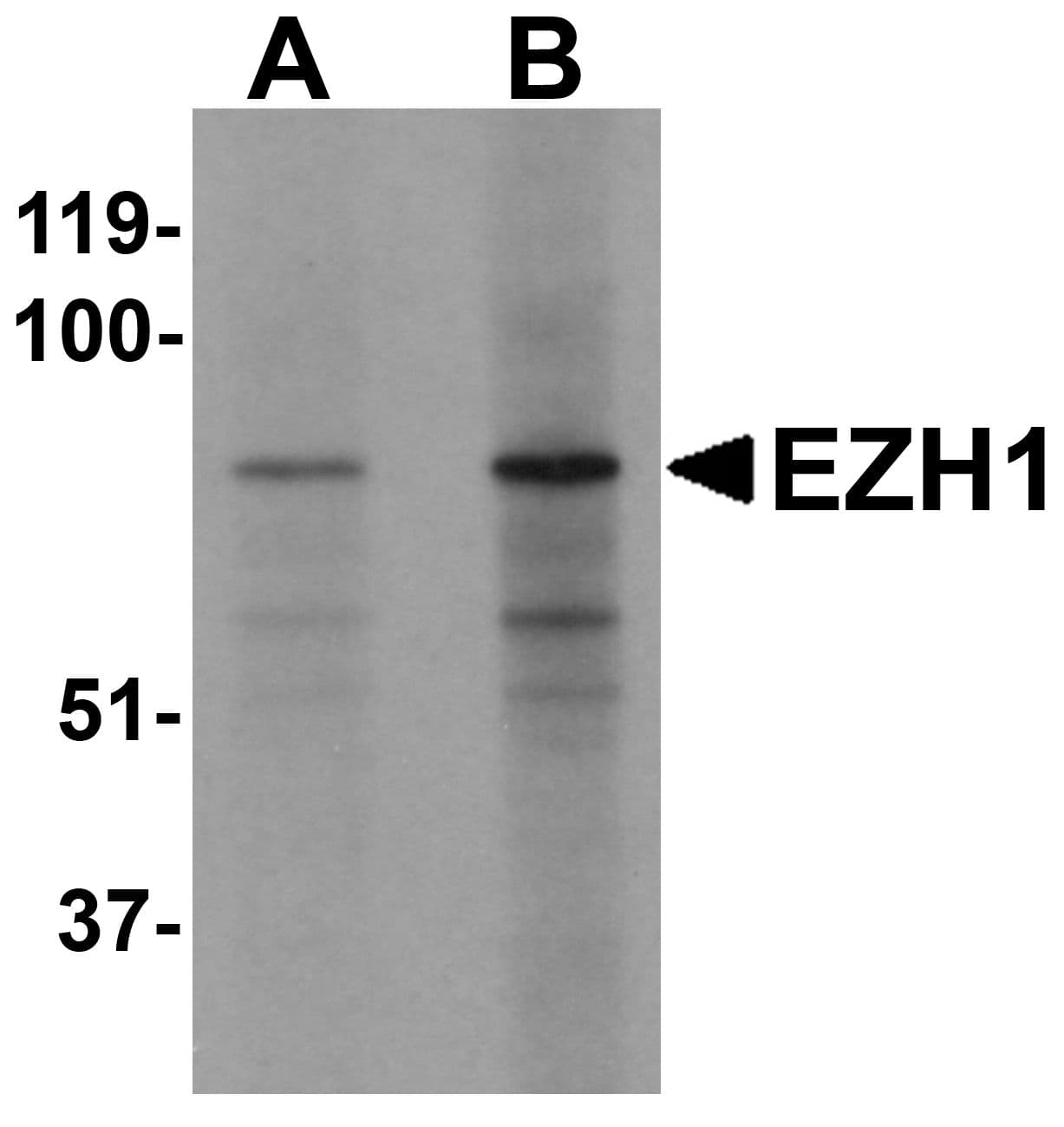 Polyclonal Rabbit anti-Human EZH1 / ENX-2 Antibody (IHC, IF, WB)