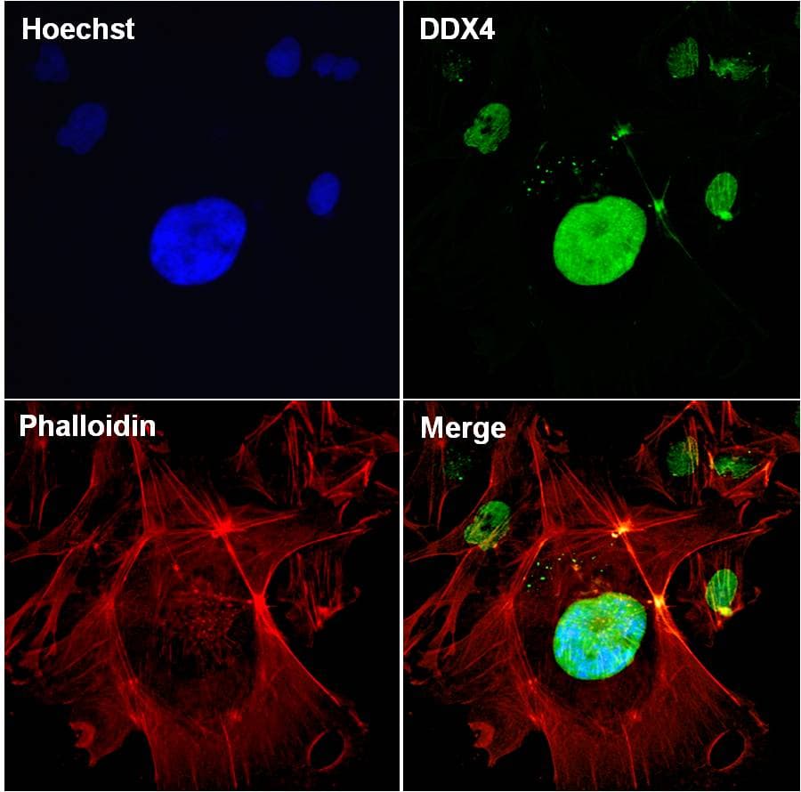 DDX4 / VASA Antibody (clone 2F9H5)