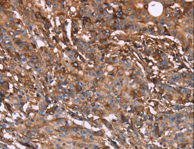 HP / Haptoglobin Antibody