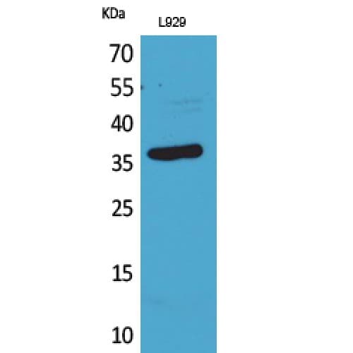 CD300LG Antibody (31-80 aa, Internal)