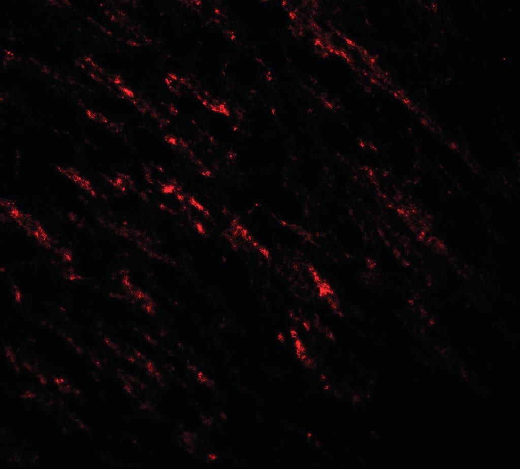 PathPlus™ BRAF / B-Raf Antibody