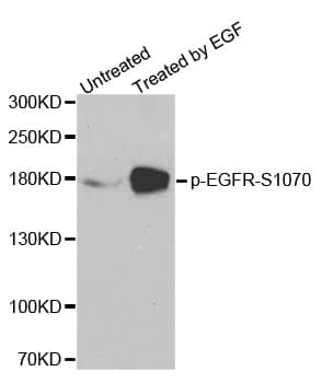 EGFR Antibody (phospho-Ser1070)