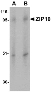 IHC-plus™ SLC39A10 / ZIP10 Antibody