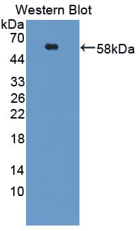 ACVR1C / ALK7 Antibody (aa21-493, Cy3)