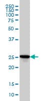 RAB27A / RAB27 Antibody (clone 1G7)