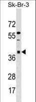 Polyclonal Rabbit anti-Human ARMC10 Antibody (aa57-86, WB)