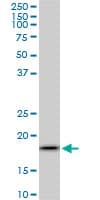 Monoclonal Mouse anti-Human ARF5 Antibody (clone 1B4, IF, WB)