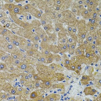 Vimentin Antibody