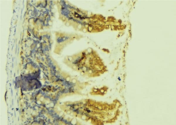CTF1 / Cardiotrophin-1 Antibody (aa43-71)