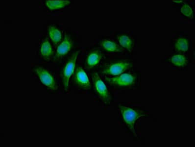 Polyclonal Rabbit anti-Human AAGAB Antibody (IHC, IF)