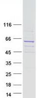Human RUNDC3B Protein (Recombinant Myc-DDK (Flag))