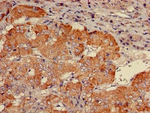 Polyclonal Rabbit anti-Human SLC9A1BP / CHP Antibody (IHC, IF, WB)
